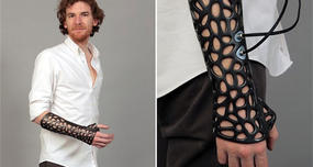 3D-Printed Cast Heals Bones 40% Faster with Ultrasound